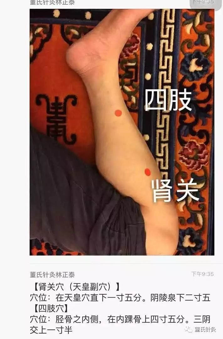 苹果版董氏针灸董氏针灸1一90集视频免费-第1张图片-太平洋在线下载